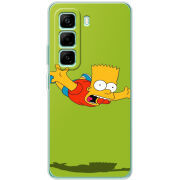 Чохол BoxFace Infinix Hot 50 Pro Plus 