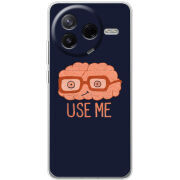 Чохол BoxFace Poco F7 Pro 