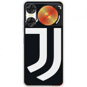 Чохол BoxFace Nubia Music 2 FC J