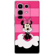 Чохол BoxFace Infinix Note 50 