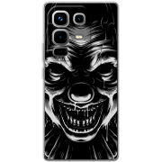 Чохол BoxFace Infinix Note 50 