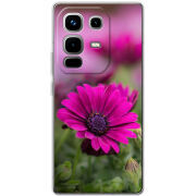 Чохол BoxFace Infinix Note 50 