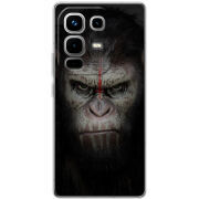 Чохол BoxFace Infinix Note 50 