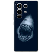 Чохол BoxFace Infinix Note 50 