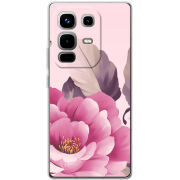 Чохол BoxFace Infinix Note 50 