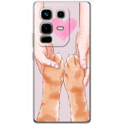 Чохол BoxFace Infinix Note 50 