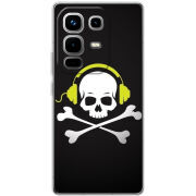 Чохол BoxFace Infinix Note 50 