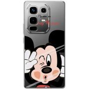 Прозорий чохол BoxFace Infinix Note 50 Mister M