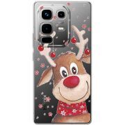 Прозорий чохол BoxFace Infinix Note 50 Winter Deer