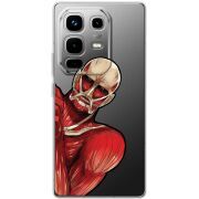 Прозорий чохол BoxFace Infinix Note 50 Титан