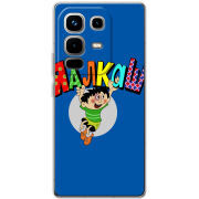 Чохол BoxFace Infinix Note 50 Pro 