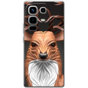 Чохол BoxFace Infinix Note 50 Pro 
