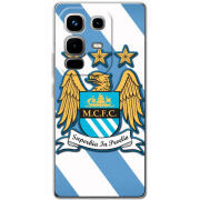 Чохол BoxFace Infinix Note 50 Pro 