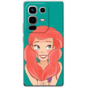 Чохол BoxFace Infinix Note 50 Pro 