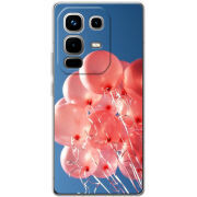 Чохол BoxFace Infinix Note 50 Pro 
