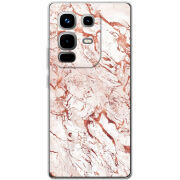 Чохол BoxFace Infinix Note 50 Pro 