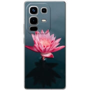Чохол BoxFace Infinix Note 50 Pro 
