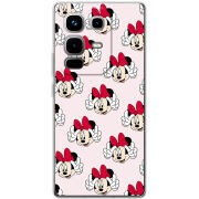 Чохол BoxFace Infinix Note 50 Pro 