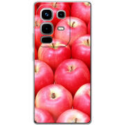Чохол BoxFace Infinix Note 50 Pro 