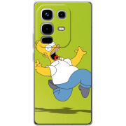Чохол BoxFace Infinix Note 50 Pro 