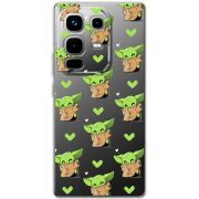 Прозорий чохол BoxFace Infinix Note 50 Pro Pattern Baby Yoda
