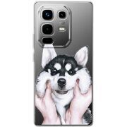 Прозорий чохол BoxFace Infinix Note 50 Pro Husky