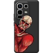 Чорний чохол BoxFace Infinix Note 50 Pro Титан