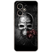 Чохол BoxFace Honor 400 