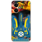 Чохол BoxFace Honor 400 UA national team
