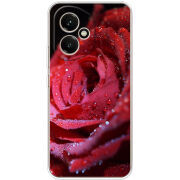 Чохол BoxFace Honor 400 