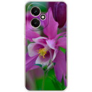 Чохол BoxFace Honor 400 