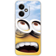 Чохол BoxFace Honor 400 