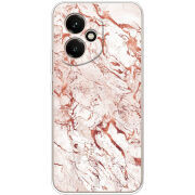 Чохол BoxFace Honor 400 