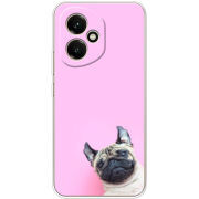 Чохол BoxFace Honor 400 