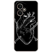 Чохол BoxFace Honor 400 
