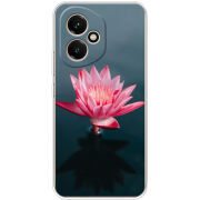 Чохол BoxFace Honor 400 