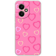 Чохол BoxFace Honor 400 Sugar Hearts