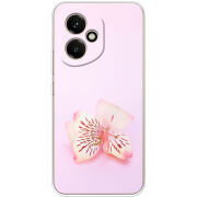 Чохол BoxFace Honor 400 