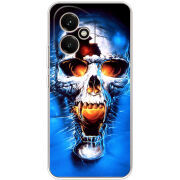 Чохол BoxFace Honor 400 