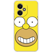 Чохол BoxFace Honor 400 