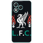 Чохол BoxFace Honor 400 Lite L. F. C.