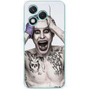 Чохол BoxFace Honor 400 Lite 