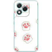 Чохол BoxFace Honor 400 Lite 