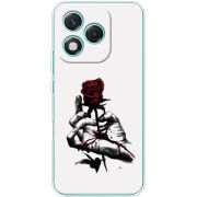 Чохол BoxFace Honor 400 Lite 
