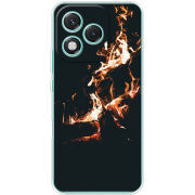Чохол BoxFace Honor 400 Lite 