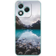 Чохол BoxFace Honor 400 Lite 