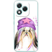 Чохол BoxFace Honor 400 Lite 