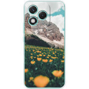 Чохол BoxFace Honor 400 Lite 