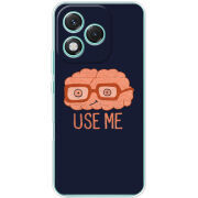 Чохол BoxFace Honor 400 Lite 