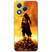 Чохол BoxFace Honor 400 Lite 